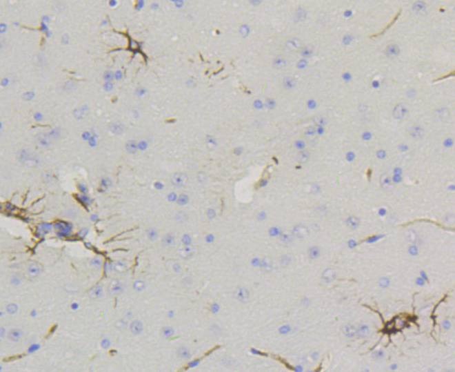 Anti-GFAP Antibody (7W409)