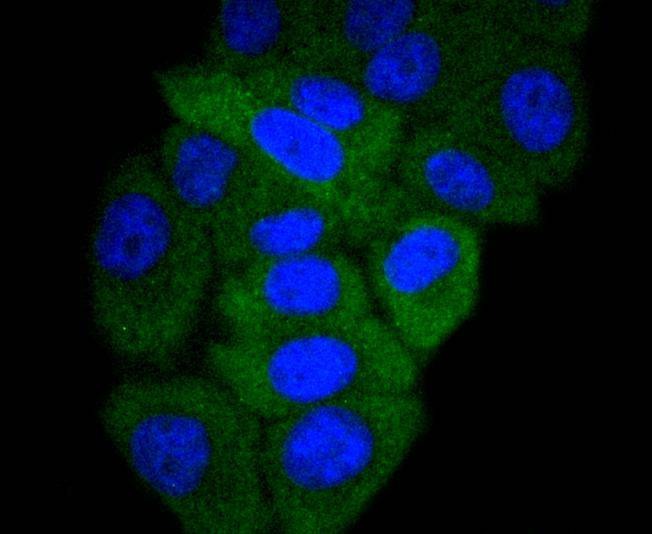 Anti-GART Antibody (9K216)