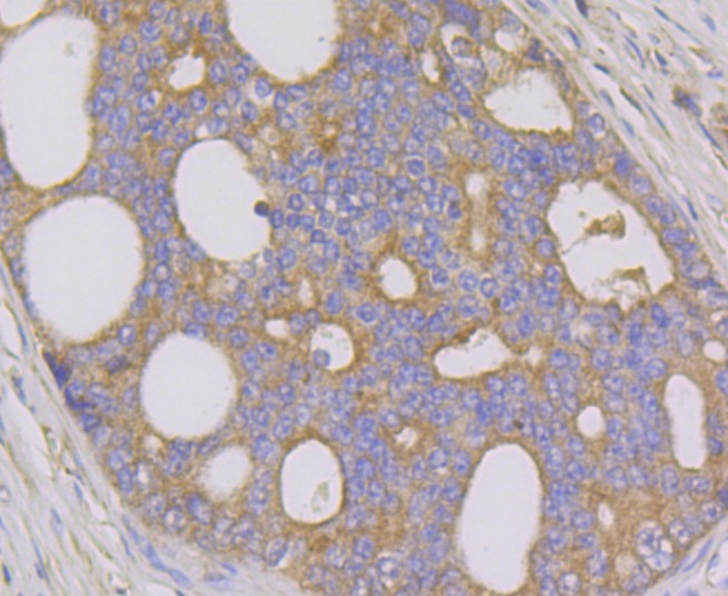 Anti-GRIM19 Antibody (2M560)