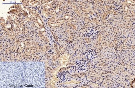 Anti-GFAP Antibody (6C642)