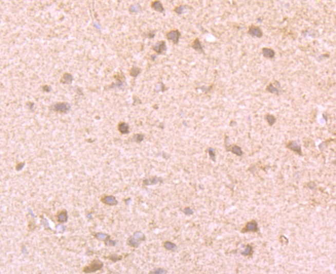 Anti-GIT1 Antibody (6A39)