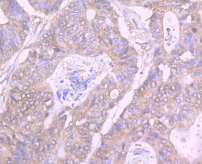 Anti-GIT1 Antibody (6A39)