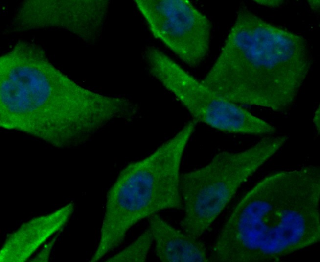 Anti-PFKM Antibody (4A746)