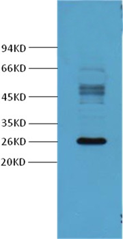 Anti-LGALS3 Antibody (2H780)