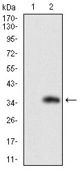 Anti-FATP2 Antibody (4L226)