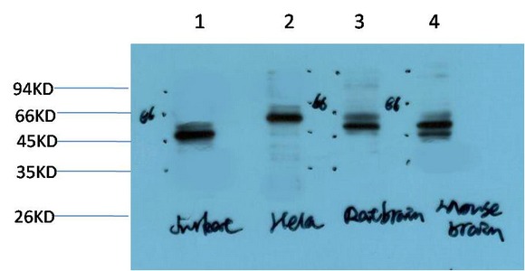 Anti-Gamma Tubulin Antibody (6T43)