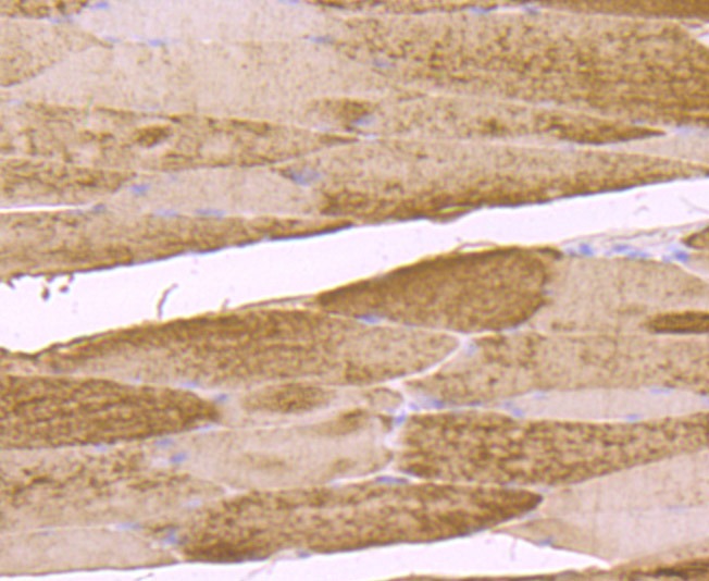 Anti-PFKM Antibody (4A746)
