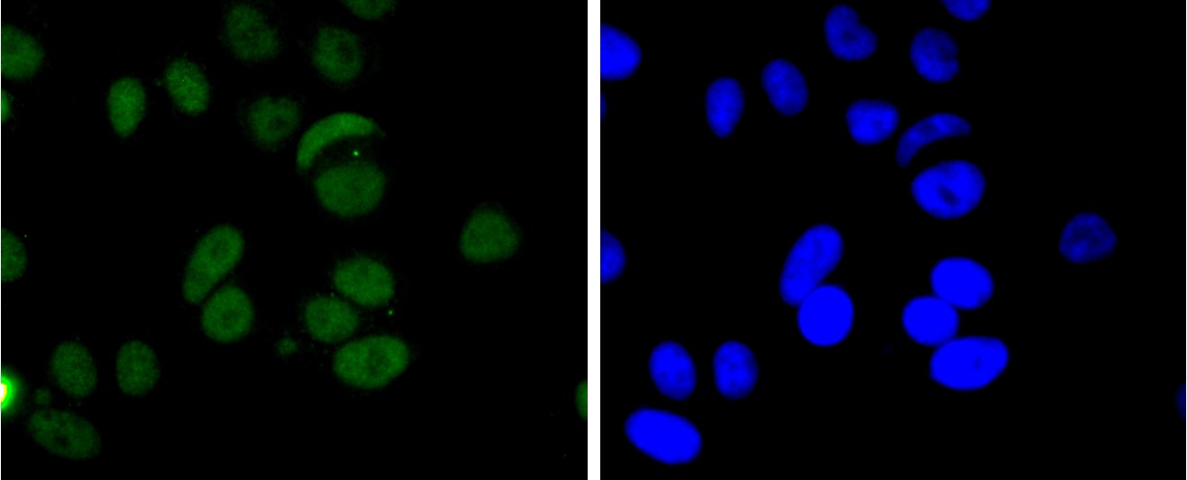 Anti-FUS Antibody (3F162)