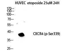 Anti-Phospho-CXCR4 (Ser339) Polyclonal Antibody