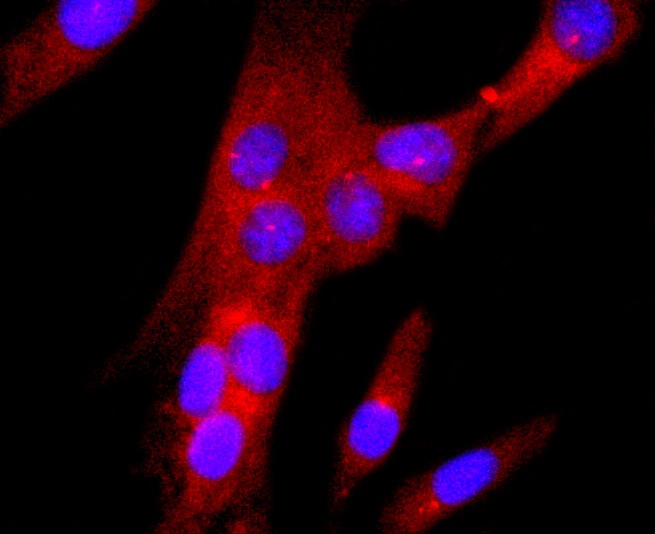 Anti-Gamma Tubulin Antibody (3T847)