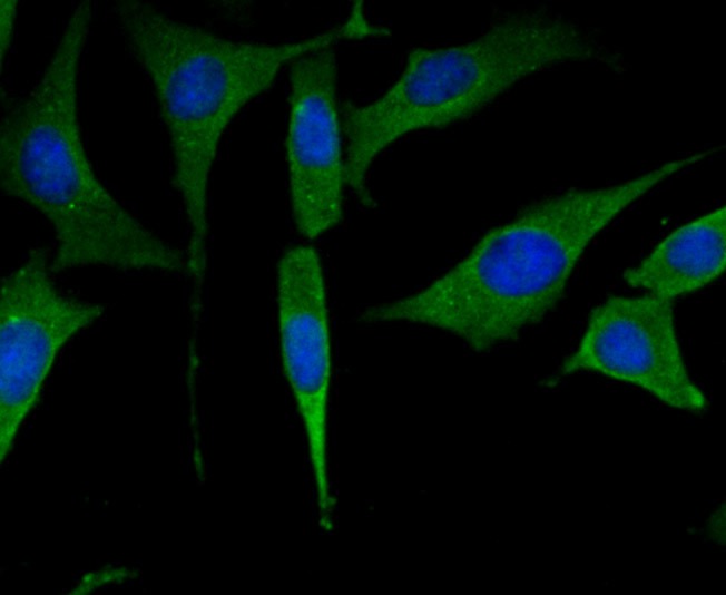 Anti-PFKM Antibody (4A746)