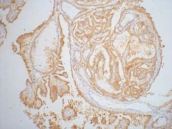 Anti-LGALS3 Antibody (2H780)
