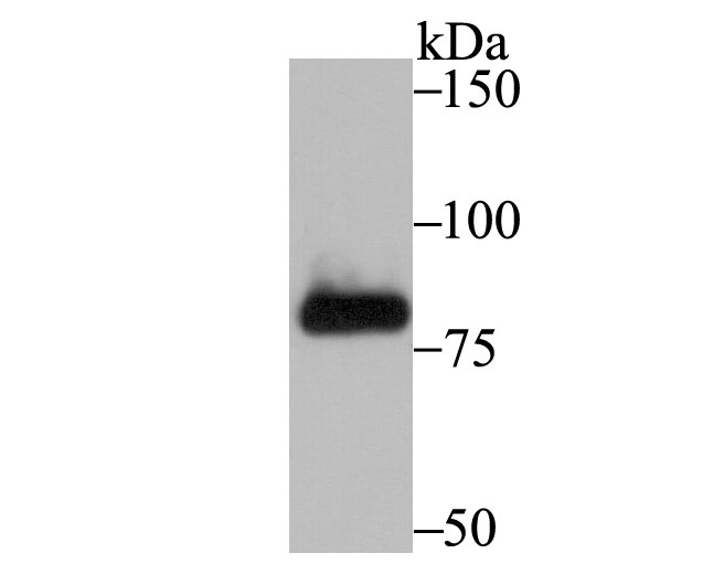 Anti-PFKM Antibody (4A746)