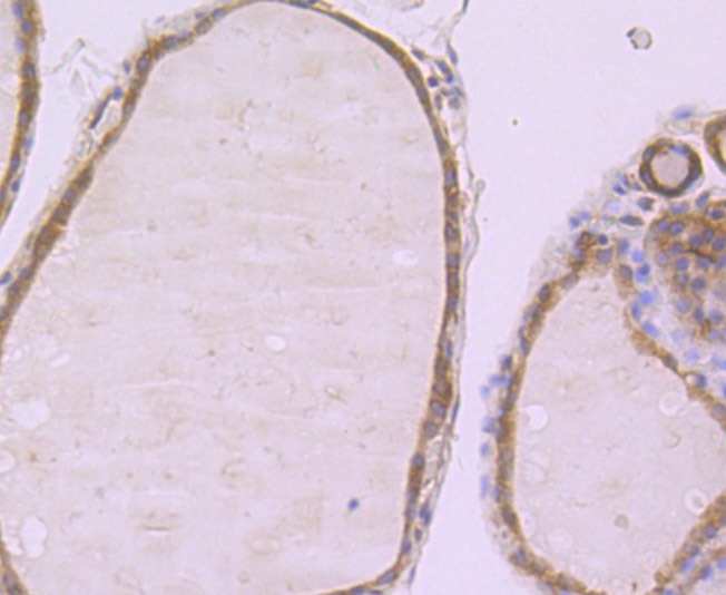 Anti-PFKM Antibody (4A746)