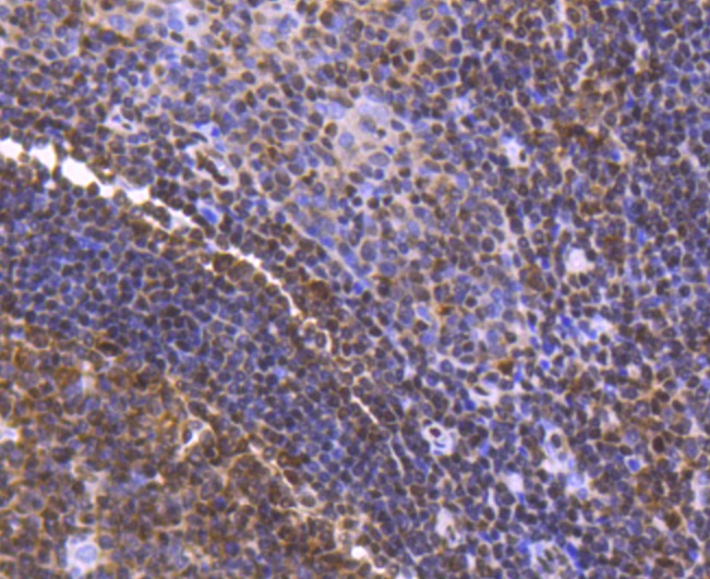 Anti-FUBP1 Antibody (1H129)