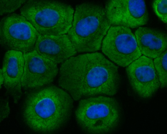 Anti-Fbx32 Antibody (6J554)