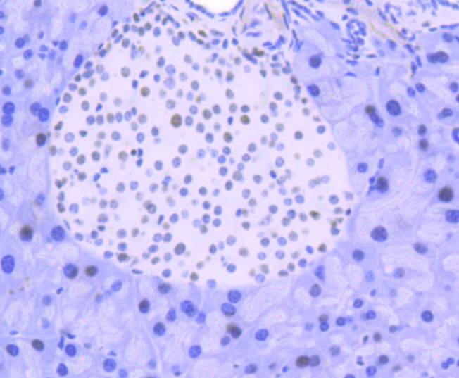 Anti-FUBP1 Antibody (1H129)