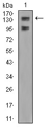 Anti-FBXL10 Antibody (6J798)