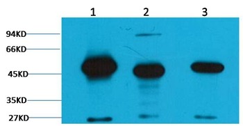 Anti-Fumarase Antibody (6O805)