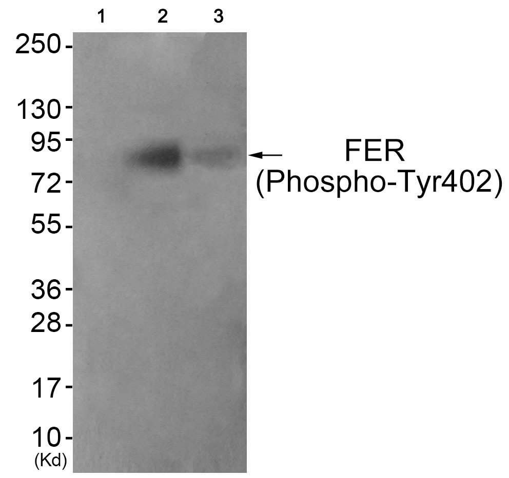 Anti-Phospho-FER (Tyr402) Polyclonal Antibody