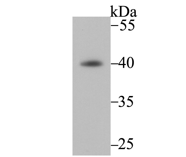 Anti-Fbx32 Antibody (6J554)