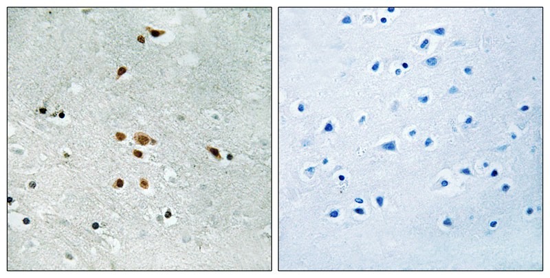 Anti-Phospho-FER (Tyr402) Polyclonal Antibody