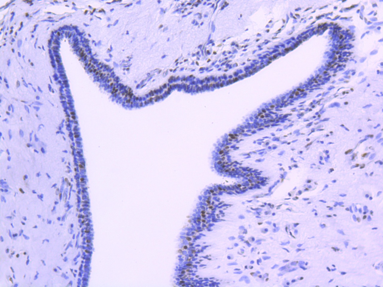 Anti-FUBP1 Antibody (1H129)
