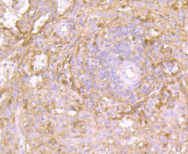 Anti-Fc epsilon RI Antibody (5H603)