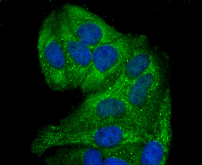 Anti-GCLM Antibody (9X353)