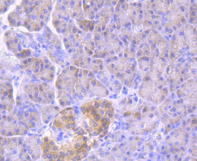 Anti-GBA Antibody (1F893)