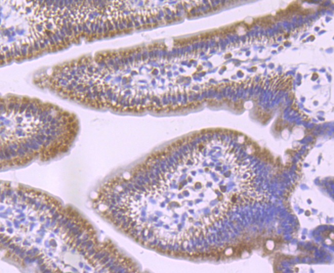 Anti-GCLM Antibody (9X353)