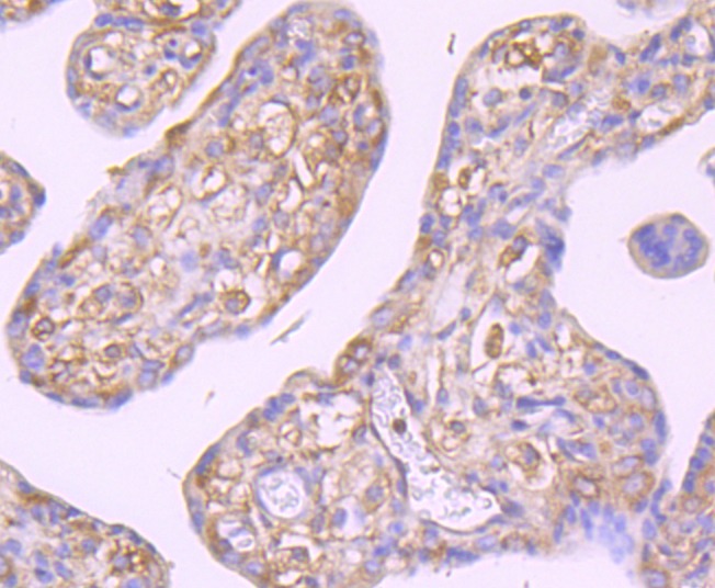 Anti-GCN2 Antibody (7U574)