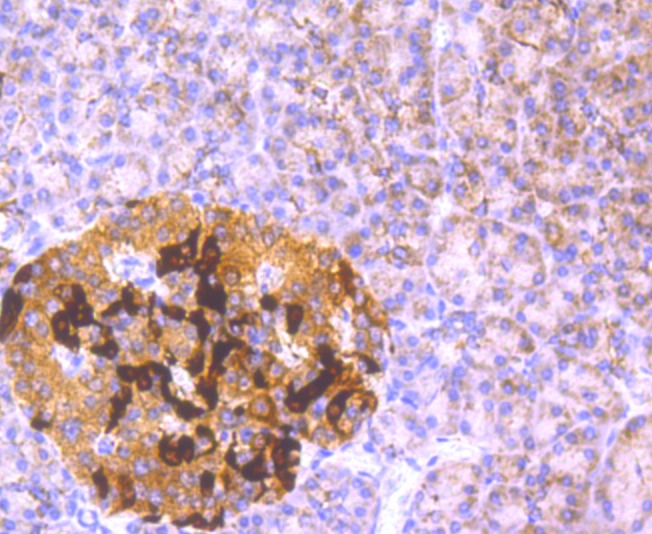 Anti-GCLM Antibody (9X353)