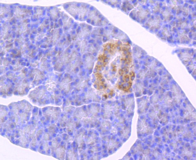 Anti-GBA Antibody (1F893)