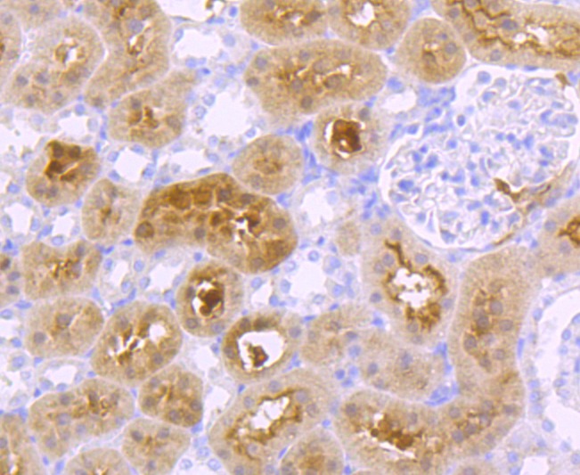 Anti-GBA Antibody (1F893)