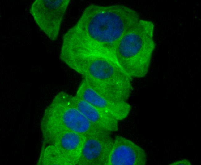 Anti-GCN2 Antibody (7U574)