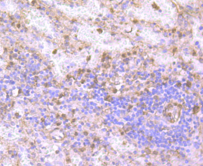 Anti-GSN Antibody (3E486)