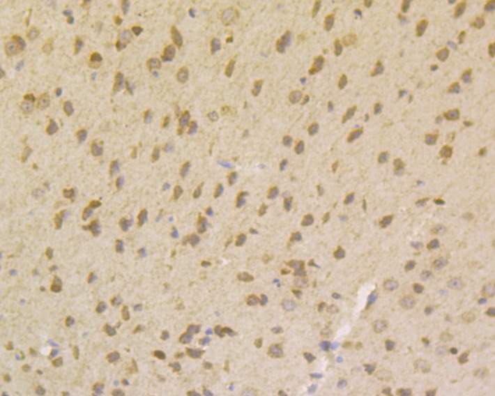Anti-SMN1 Antibody (9G111)
