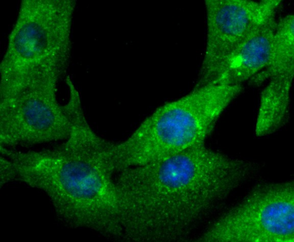 Anti-GSN Antibody (3E486)