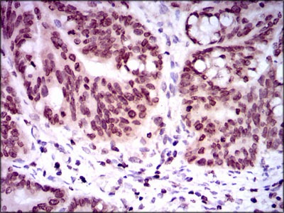 Anti-GCNF Antibody (6U757)