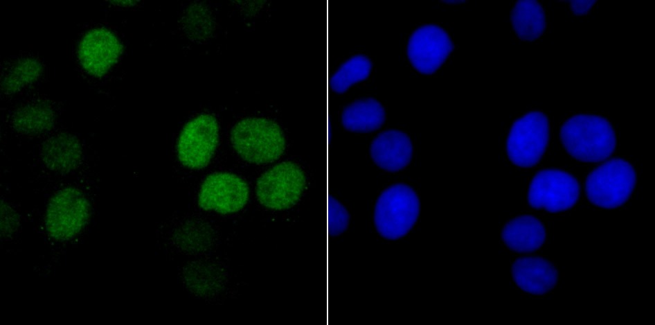 Anti-HIST1H1C Antibody (3S922)