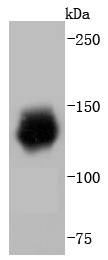 Anti-HDAC6 Antibody (7M972)