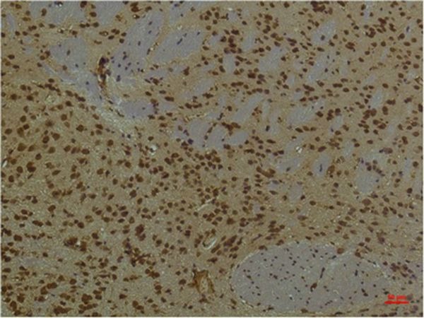 Anti-ARNT Antibody (8R720)
