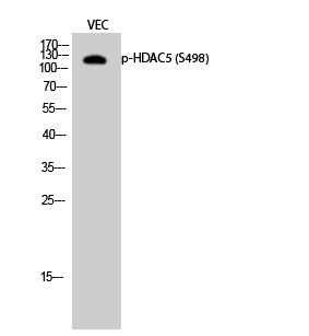 Anti-Phospho-HDAC5 (Ser498) Polyclonal Antibody