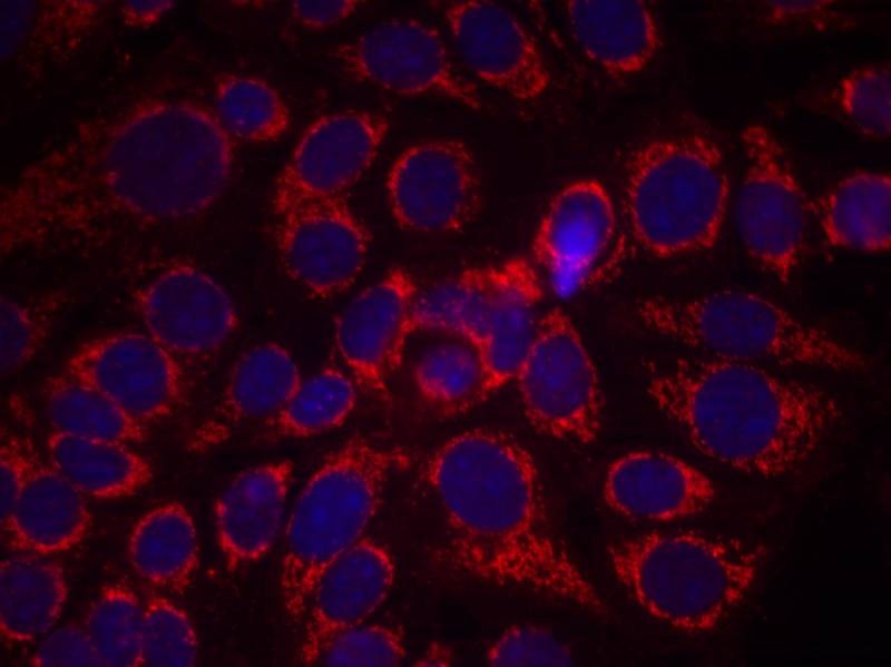 Anti-Phospho-HER2/ERBB2 (Tyr1248) Polyclonal Antibody 2
