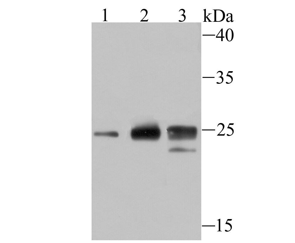 Anti-HIST1H1C Antibody (3S922)