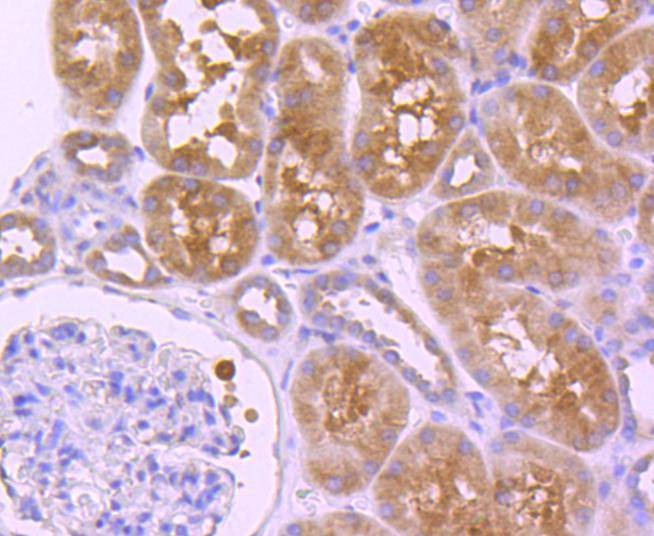 Anti-HDAC6 Antibody (7M972)