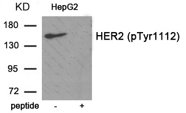 Anti-Phospho-HER2/ERBB2 (Tyr1112) Polyclonal Antibody 2