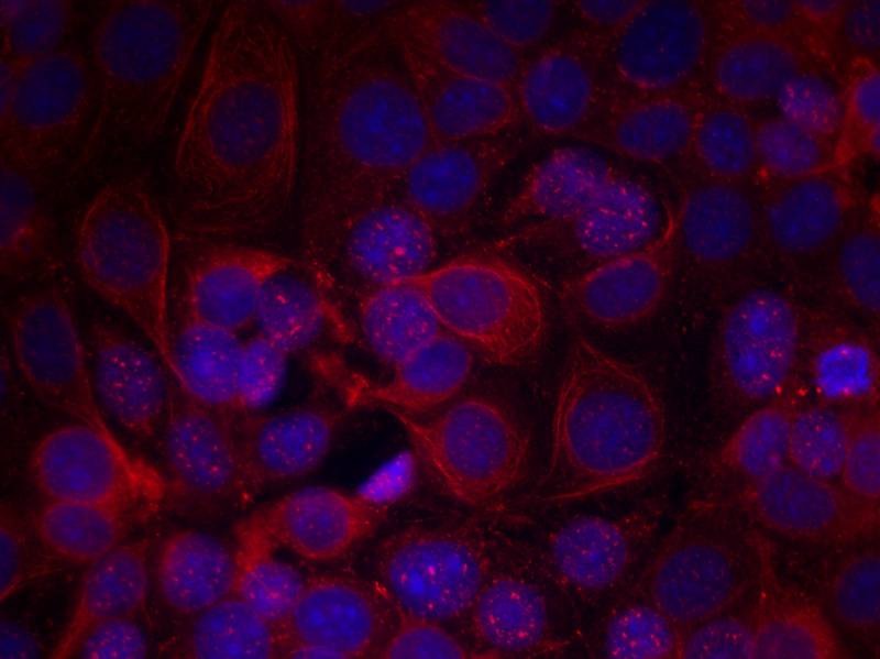 Anti-Phospho-HER2/ERBB2 (Tyr1221, 1222) Polyclonal Antibody 3