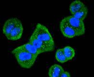Anti-HDAC10 Antibody (7E996)
